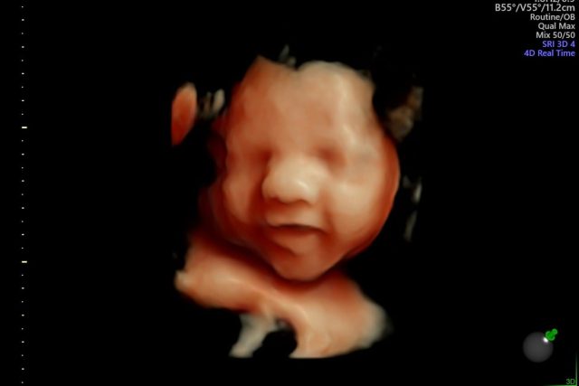 Already practicing that smile for newborn photoshoots! We love being able to capture these precious moments for y'all! 
#thorstudio #bondingbeforebirth #maternalsupport #fromthewombtotheworld #momssupportingmoms #4dultrasound #smile