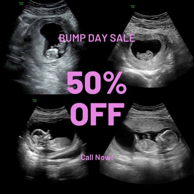 Every Wednesday is Bump Day here at Tiny Hearts of Rockwall! Get 50% off an Early Peek appointment when you call our office and use the code: WednesdayBaby while booking! 
#thorstudio #maternalsupport #momssupportingmoms #bondingbeforebirth #fromthewombtotheworld #2dultrasound