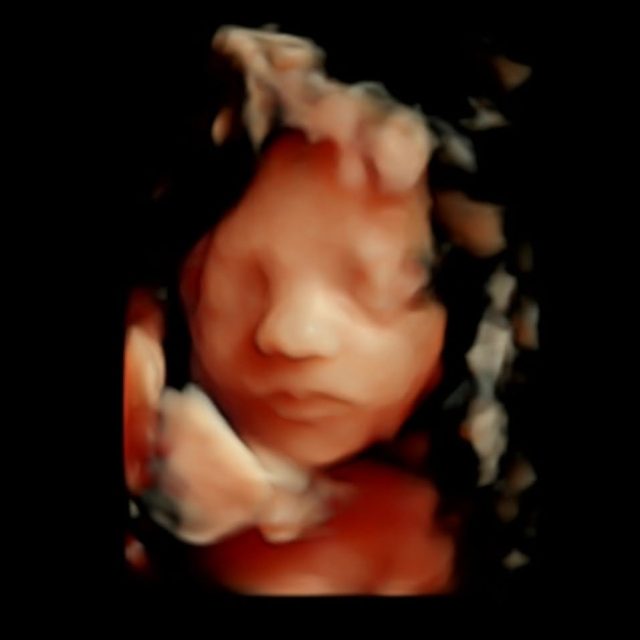 Here to capture the perfect moments, whether it's their sweet faces or hilarious personalities!
#thorstudio #maternalsupport #momssupportingmoms #bondingbeforebirth #fromthewombtotheworld #UltrasoundBoutique #rockwalltx